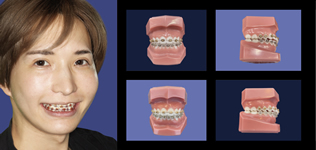 kawaii矯正®歯科治療 for men